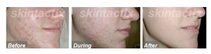 Welcome to Skintactix
